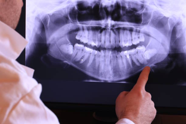 Best Chipped Tooth Repair Near Me  in Milltown, NJ